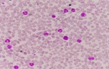 CAR-T cells