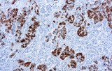 Anti-ACTH CE/IVD for IHC - Neuropathology