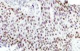 Anti-c-Myc CE/IVD for IHC - Hematopathology