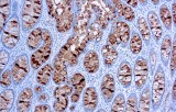 Anti-CA 19-9 CE/IVD for IHC - Gastrointestinal pathology