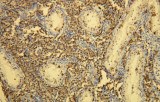 Anti-CD117 / c-kit CE/IVD for IHC - Gynecological pathology