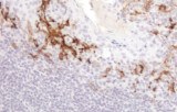 Anti-CD16 CE/IVD for IHC - Hematopathology