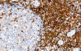 Anti-CD4 CE/IVD for IHC - Hematopathology