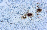 Anti-CD61 CE/IVD for IHC - Hematopathology