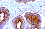 Anti-CEA CE/IVD for IHC - Gynecological pathology