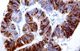 Anti-Cytokeratin 20 CE/IVD for IHC - Genitourinary pathology