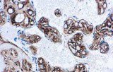 Anti-Collagen IV CE/IVD for IHC - Dermopathology