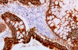 Anti-COX-2 CE/IVD for IHC - Gynecological pathology