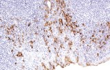 Anti-CTLA4 CE/IVD for IHC - Hematopathology