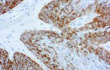 Anti-Cytokeratin 14 CE/IVD for IHC - Genitourinary pathology