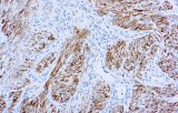 Anti-Desmin CE/IVD for IHC - Soft Tissue pathology