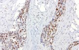 Anti-ERCC1 CE/IVD for IHC - Pulmonary pathology