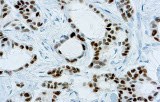 Anti-Estrogen receptor (ER) CE/IVD for IHC - Gynecological pathology