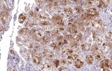 Anti-FSH CE/IVD for IHC - Neuropathology