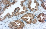 Anti-Galectin-3 CE/IVD for IHC - Cytopathology