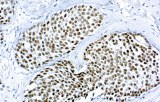 Anti-GATA3 CE/IVD for IHC - Gynecological pathology