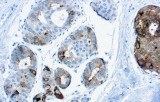 Anti-GCDFP-15 CE/IVD for IHC - Gynecological pathology