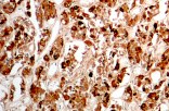 Anti-Growth Hormone (GH) CE/IVD for IHC - Neuropathology