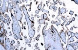 Anti-hCG CE/IVD for IHC - Genitourinary pathology