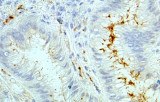 Anti-Helicobacter pylori CE/IVD for IHC - Gastrointestinal pathology