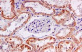 Immunohistochemistry