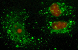 Fluorescent microscopy