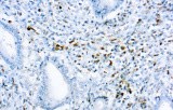 Anti-Kappa CE/IVD for IHC - Hematopathology