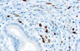 Anti-Lambda CE/IVD for IHC - Hematopathology