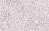 Anti-MDR3 CE/IVD for IHC - Pediratic pathology