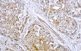 Anti-MMP9 CE/IVD for IHC - Genitourinary pathology