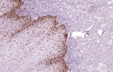 Anti-MSH6 CE/IVD for IHC - Gastrointestinal pathology