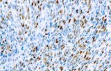 Anti-MyoD1 CE/IVD for IHC - Soft Tissue pathology