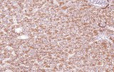 Anti-N-Cadherin CE/IVD for IHC - Dermopathology