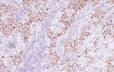 Anti-Nanog CE/IVD for IHC - Pediatric pathology