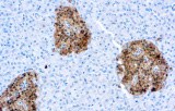 Anti-Neuron Specific Enolase (NSE) CE/IVD for IHC - Neuropathology