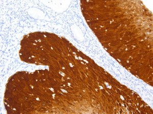 Try our new p16 antibody
