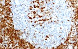 Anti-p27 KIP1 CE/IVD for IHC - Hematopathology