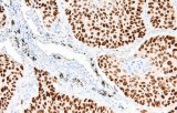 Anti-p40 CE/IVD for IHC - Pulmonary pathology