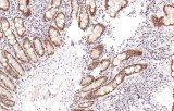 Anti-PMS2 CE/IVD for IHC - Gastrointestinal pathology