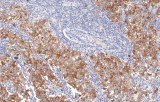 Anti-Podoplanin CE/IVD for IHC - Soft tissue pathology