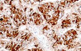 Anti-Prolactin CE/IVD for IHC - Neuropathology