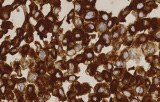 Anti-ROS1 CE/IVD for IHC - Pulmonary pathology