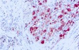 Anti-S-100 CE/IVD for IHC - Neuropathology