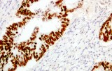 Anti-SATB2 CE/IVD for IHC - Gastrointestinal pathology