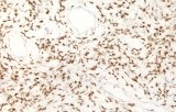 Anti-STAT6 CE/IVD for IHC - Soft tissue pathology