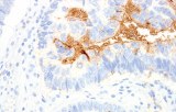 Anti-TAG-72 CE/IVD for IHC - Pulmonary pathology