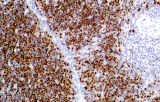 Anti-TdT CE/IVD for IHC - Hematopathology