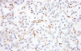 Anti-TFE3 CE/IVD for IHC - Pediatric pathology