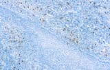 Anti-Tryptase CE/IVD for IHC - Hematopathology