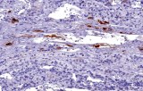 Anti-TSH CE/IVD for IHC - Neuropathology